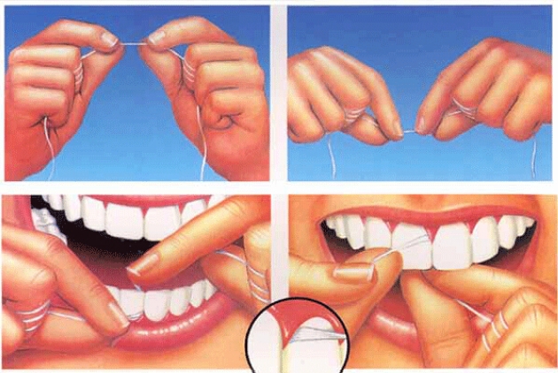 牙线的使用方法
