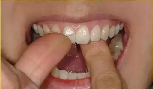 牙线怎么使用
