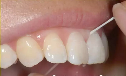 牙线的使用方法