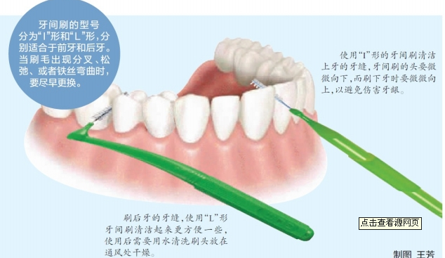 牙缝刷的使用方法